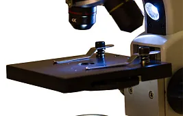 Микроскопия осадка мочи: расшифровка