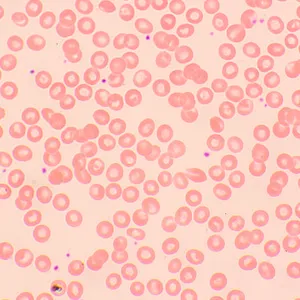 Микроскоп биологический цифровой MAGUS Bio D250TL LCD, изображение 29