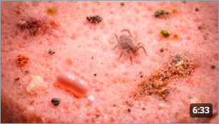 Как выглядит колбаса под микроскопом?